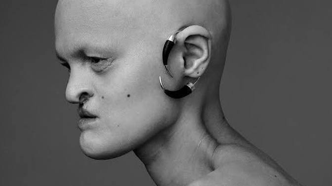 Melanie je navzdory svému postižení velmi žádanou modelkou