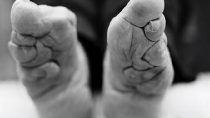 Hrozný rituál mrzačil dívkám nohy po generace. Jen aby byly pro muže atraktivní