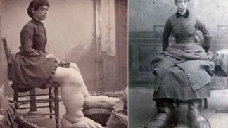 Žena s největšími chodidly na světě.