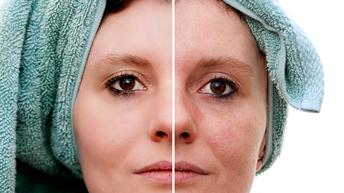 Tmavé skvrny mohou z vaší pleti zmizet snadno a rychle.