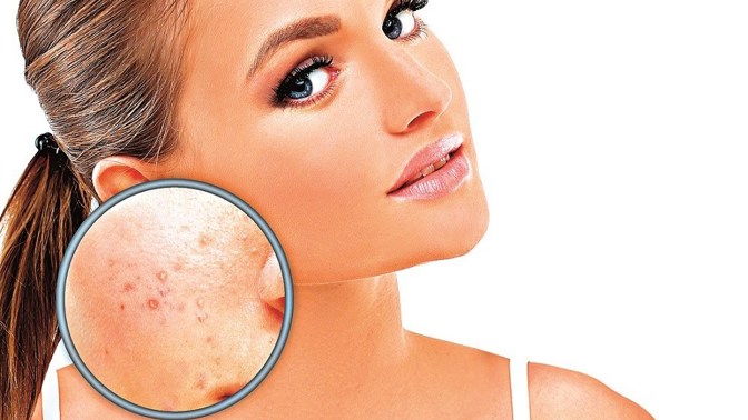 Kontrolujte si skvrny jak na viditelných, tak intimních partiích