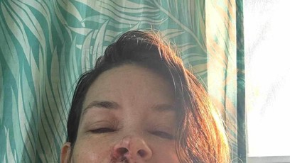 FOTO: Herečka má poškozený mozek.