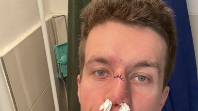 FOTO: Daniel Krejčík nešťastně spadl.