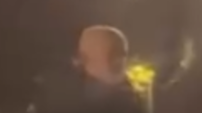 FOTO: Brutální útok v Teplicích.