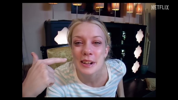 Několik dívek muselo podstoupit zbroušení zubů nebo úpravu mezer mezi zuby.