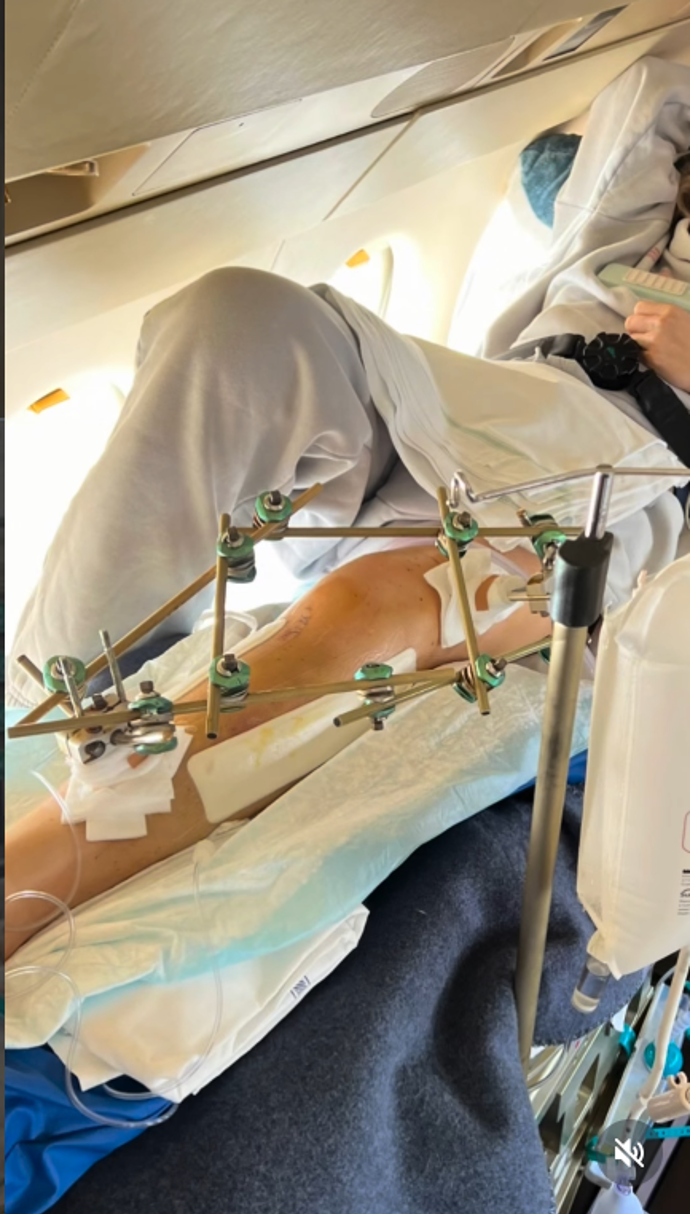  Lindsey Vonn má nohu na maděru.