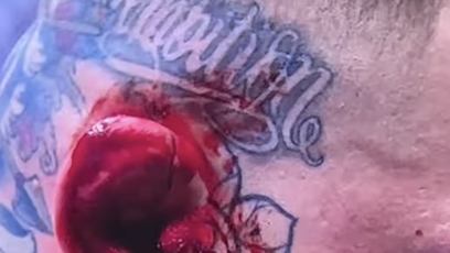 FOTO: Pokousané ucho Václava Mikuláška.