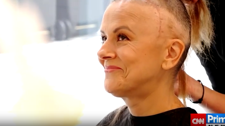 Laďka Něrgešová si nechala oholit hlavu.