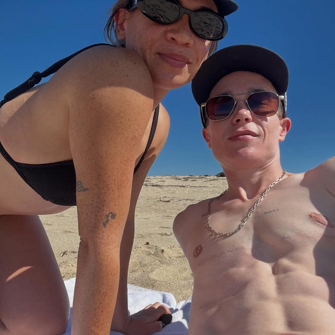 Elliot Page má po operaci stále viditelné jizvy.