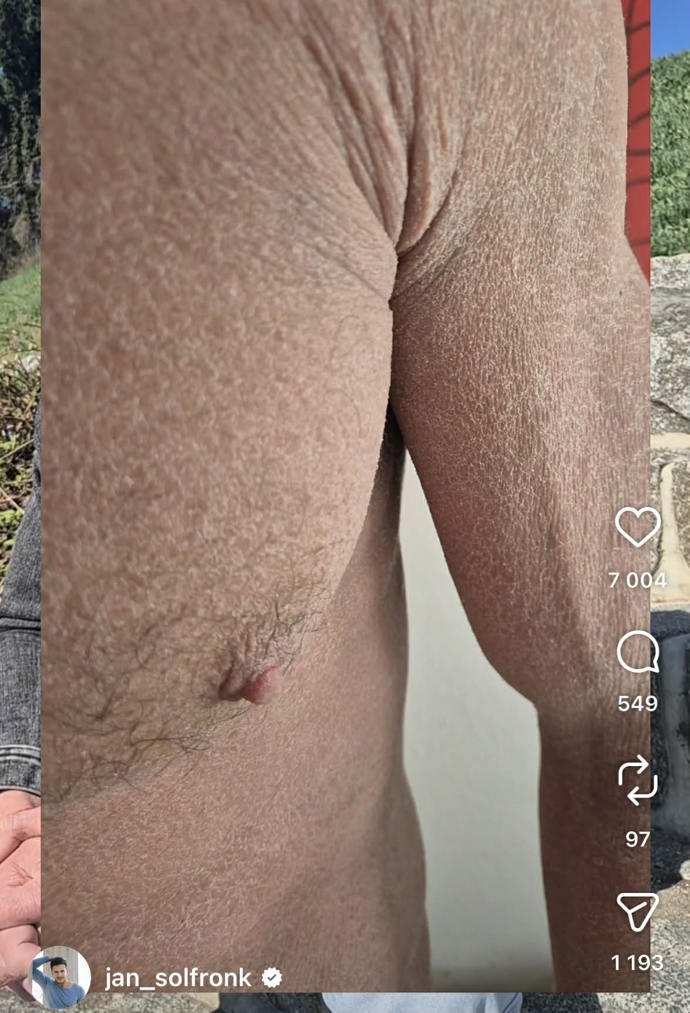 Jan Solfronk bojoval v posledních měsících s vážnými zdravotními problémy.