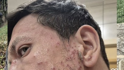 FOTO: Jan Solfronk má za sebou asi nejtěžší období v životě.