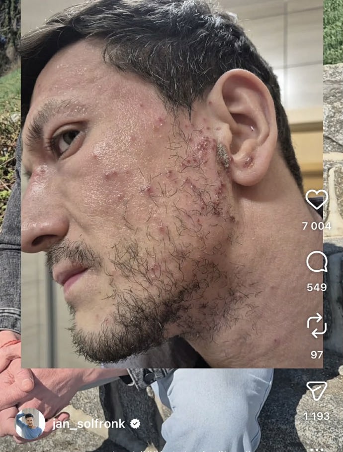 Jan Solfronk má za sebou asi nejtěžší období v životě.