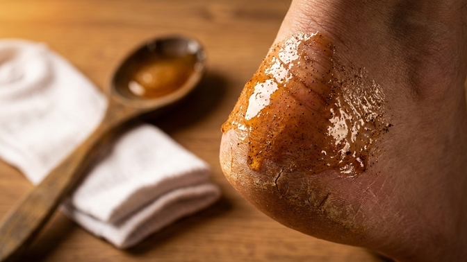 Domácí zábal na popraskané paty: Proč funguje med se skořicí?