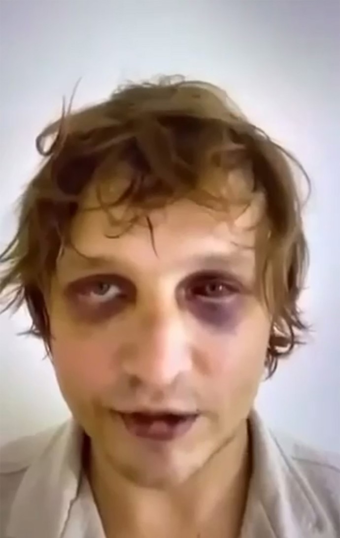 Komarov byl několik dní mučem aby pachatelé získali výkupné.