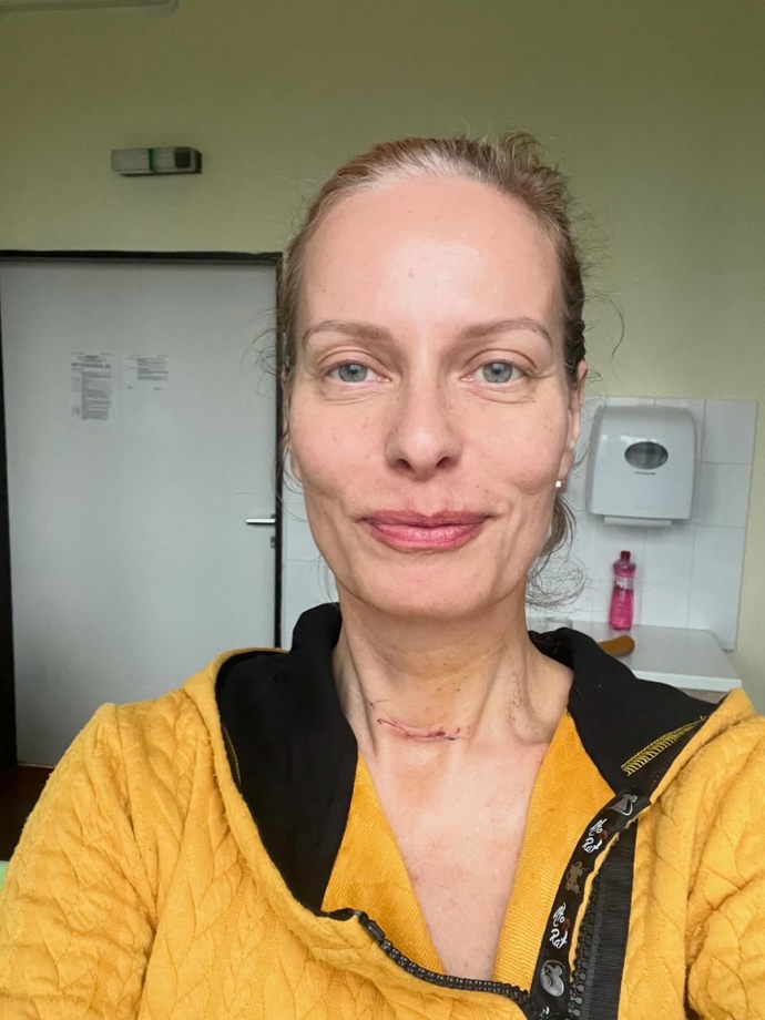 Kristina Kloubková ukázala jizvu po operaci.