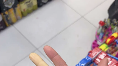 FOTO: Aneta Vignerová má takzvaný Raynaudův syndrom.