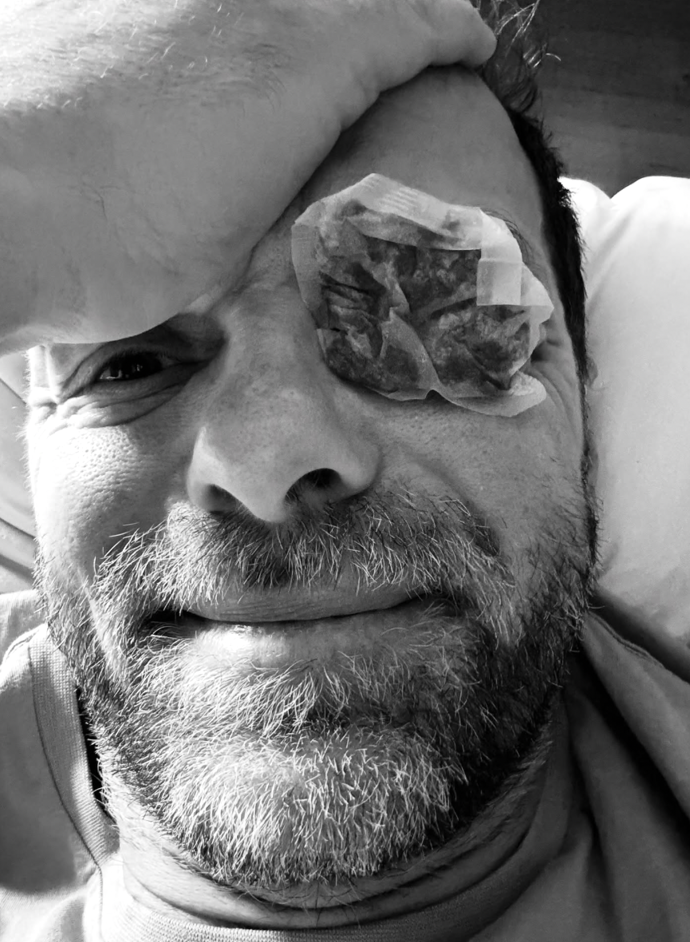 Lukáš Langmajer ukázal zalepené oko.