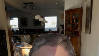 FOTO: Herečce lékaři objevili hned pět zhoubných nádorů a museli jí operativně odstranit polovinu prsu.