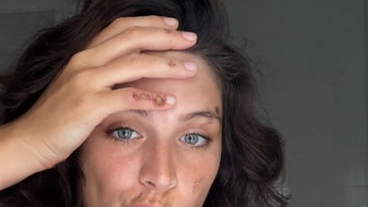 FOTO: Paulína Boško už se z n ehody zotavuje.