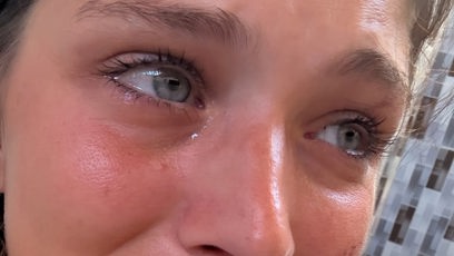 FOTO: Paulína Bošková měla nehodu na motorce.