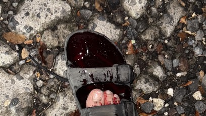 FOTO: Následky nehody Paulíny Boško.