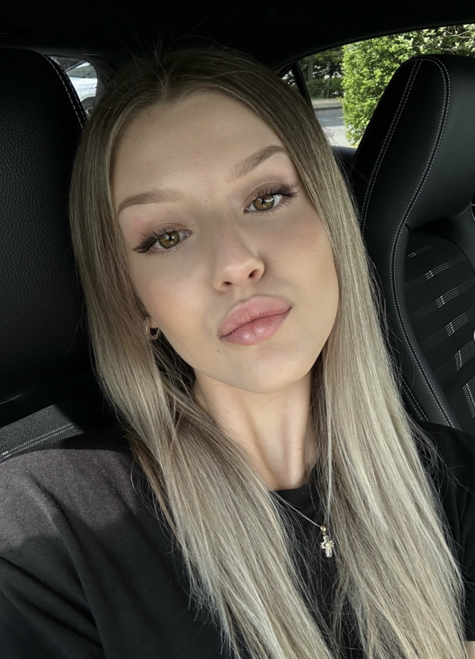 Natálie Jirásková schytala kritiku za údajné plastiky.