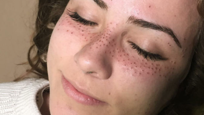 Nový beauty trend? Vytetované pihy!