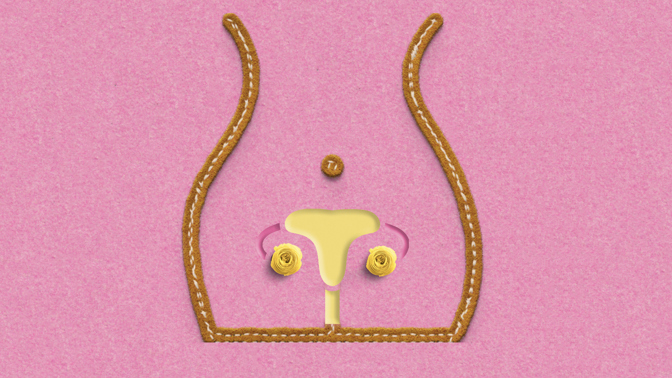PCOS