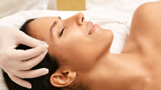 Akupunktura jako nový botox: Pomůže na vrásky, povadlou pleť i váčky pod očima