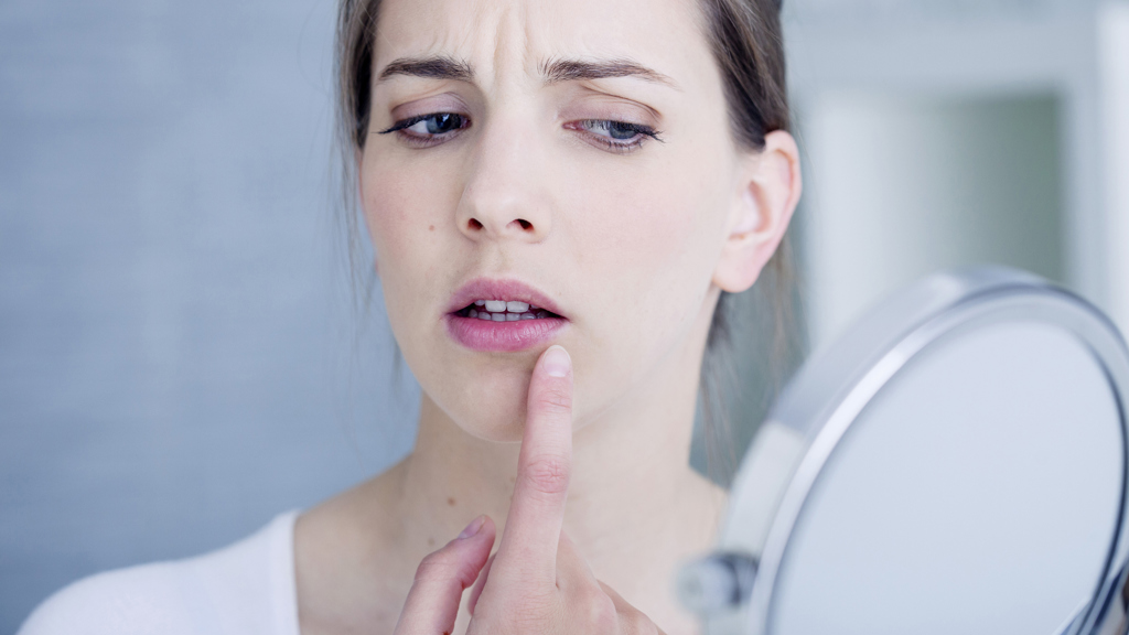 Vymačkávání pupínků lidi těší, říká dermatoložka Sandra Lee