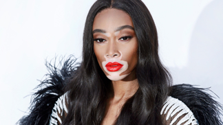 Supermodelka s vitiligem Winnie Harlow