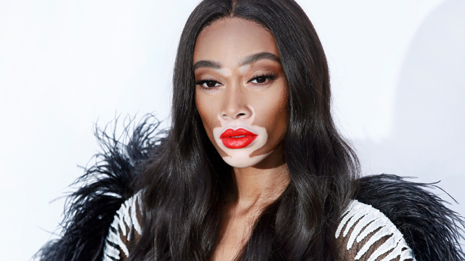 Supermodelka s vitiligem Winnie Harlow