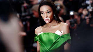 Winnie Harlow