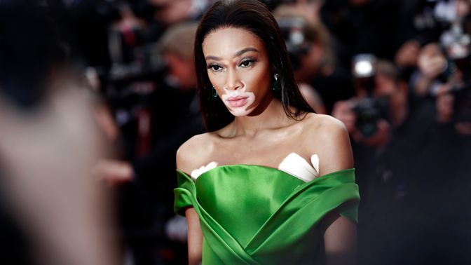 Winnie Harlow