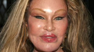 Jocelyn Wildenstein