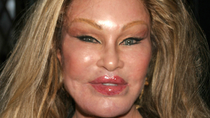 Jocelyn Wildenstein