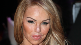 Katie Piper