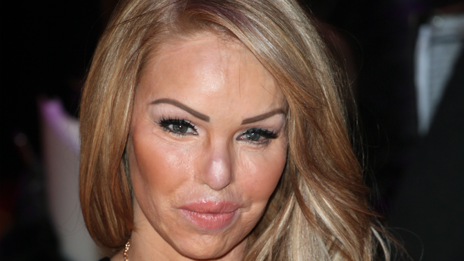 Katie Piper