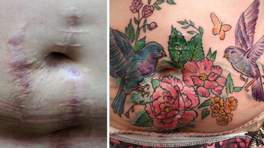 Tato umělkyně mění jizvy v něco krásného