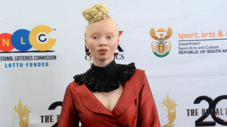 Nejznámější modelka s albinismem Thando Hopa Nejznámější modelka s albinismem Thando Hopa