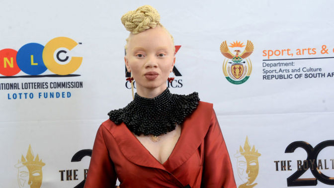 Nejznámější modelka s albinismem Thando Hopa