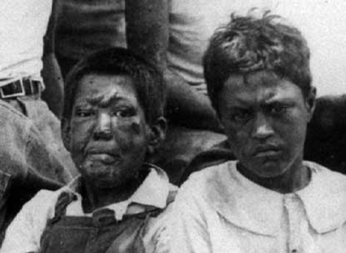Havajští chlapci s malomocenstvím, infekčním onemocněním způsobovaným bakterií Mycobacterium leprae, která napadá periferní nervy, kůži a sliznice. Havajští chlapci s malomocenstvím, infekčním onemocněním způsobovaným bakterií Mycobacterium leprae, která napadá periferní nervy, kůži a sliznice.