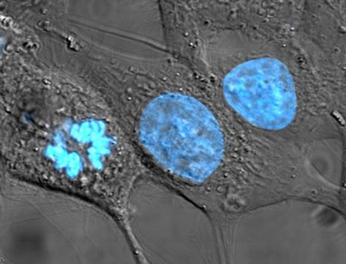Buňky HeLa s obarvenou DNA modře (barvivo Hoechst 33258). Buňka vlevo zastižena v mitóze, prostřední a pravá buňka v interfázi.
