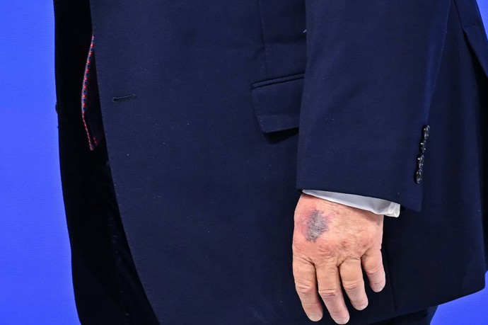 Zdraví Donalda Trumpa se opět diskutuje. 