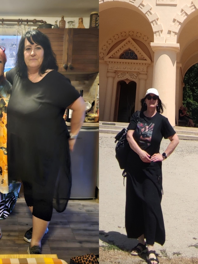 Před zahájením léčby antiobezitiky jsem vážila přes 100 kg. Druhá fotografie je sedm měsíců od zahájení léčby. Před zahájením léčby antiobezitiky jsem vážila přes 100 kg. Druhá fotografie je sedm měsíců od zahájení léčby.