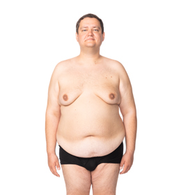 Michal před proměnou vážil 133 kilo.