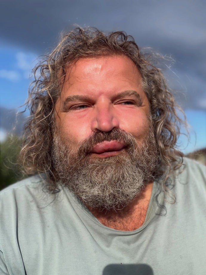 Josef Maršálek s oteklou pusou.