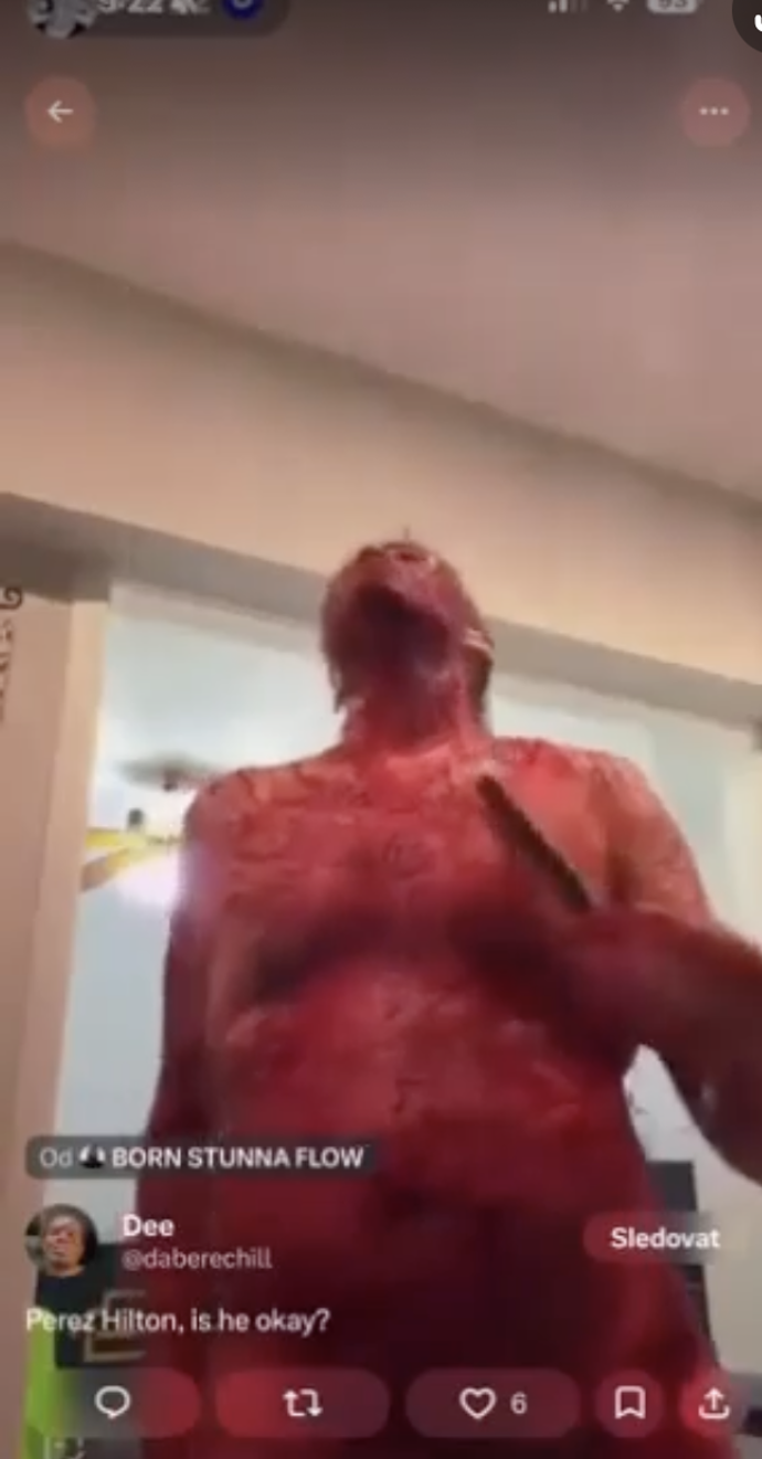 Perez Hilton už je nyní prý stabilizovaný. 