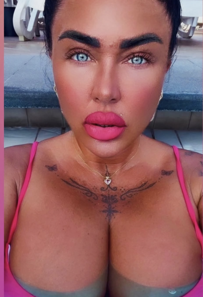 Marie Růžičková si zažila děsivou nehodu. 