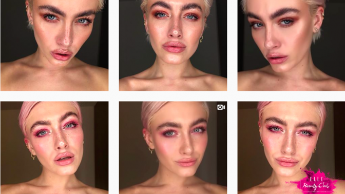 Brow lifting